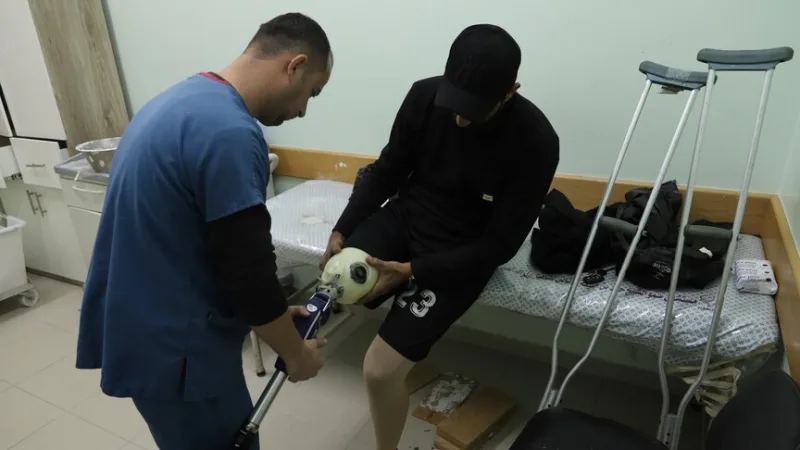 В Газе, находящейся под израильской блокадой, палестинцы месяцами ждут, чтобы получить протезы