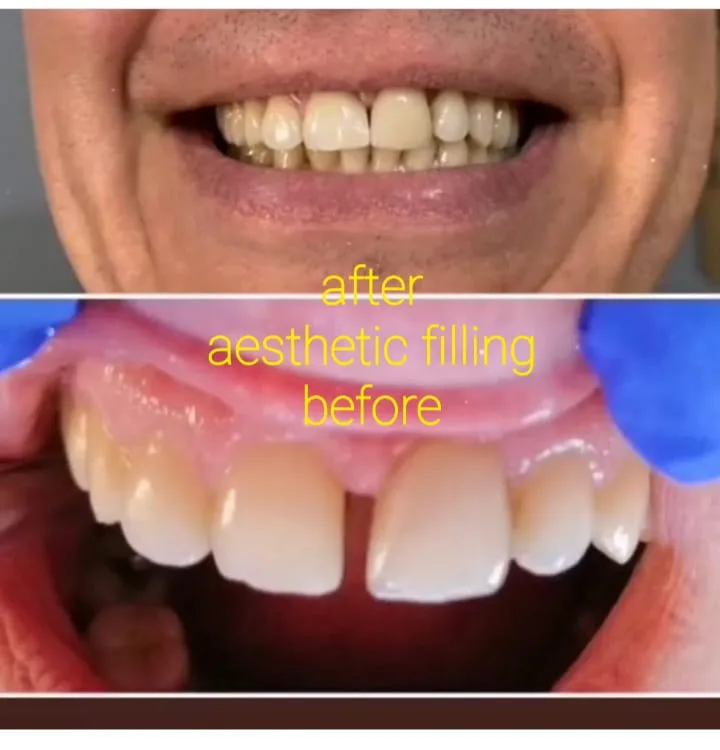 Alanya HEALTHY TEETH Dental Aesthetic — Medizin in Alanya: Online-Bestellung, Preise und Bewertungen