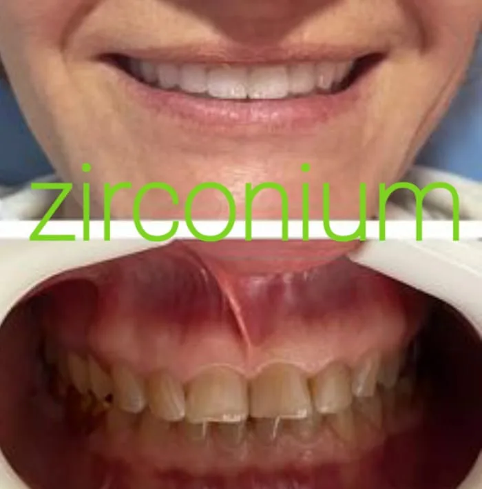 Alanya HEALTHY TEETH Dental Aesthetic — Medizin in Alanya: Online-Bestellung, Preise und Bewertungen