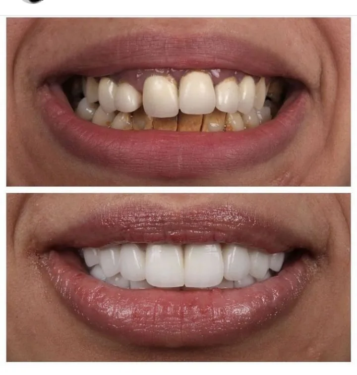 Alanya HEALTHY TEETH Dental Aesthetic — Medizin in Alanya: Online-Bestellung, Preise und Bewertungen