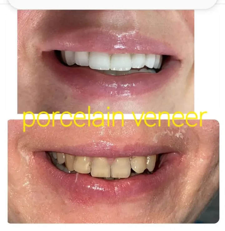 Alanya HEALTHY TEETH Dental Aesthetic — Medizin in Alanya: Online-Bestellung, Preise und Bewertungen